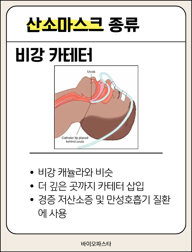 산소마스크 종류 : 비강 카테터
