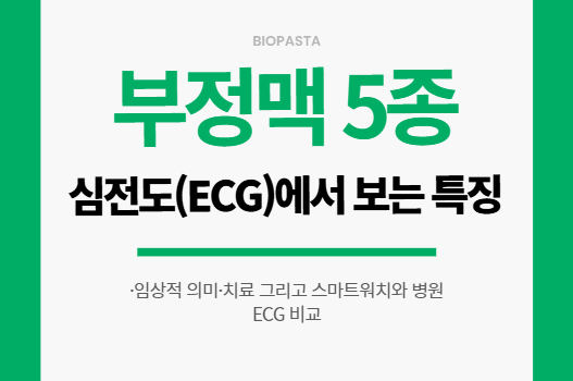 부정맥 5종: ECG(심전도)로 보는 특징 부정맥 5종.