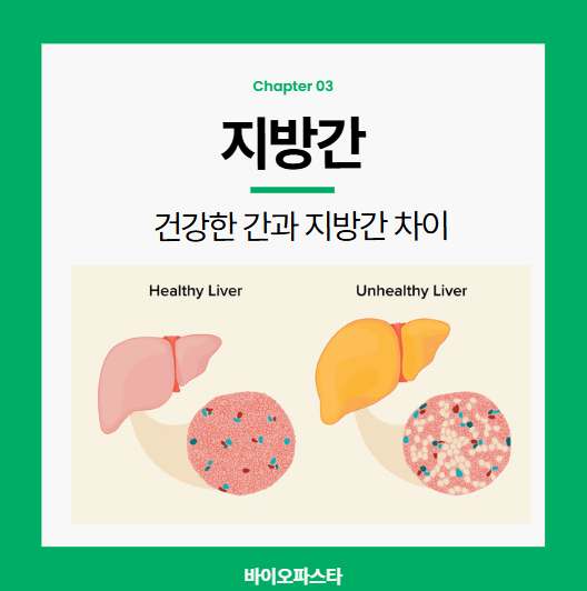 지방간, 건강한 간 차