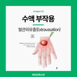 수액 부작용 종류 : 혈관 외 유출