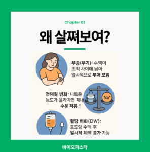 살찐것처럼 보이는 이유