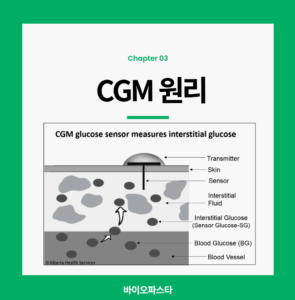 연속혈당측정기 CGM 원리