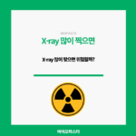 X-ray 많이 찍으면 위험할까?