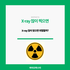 X-ray 많이 찍으면 위험할까?
