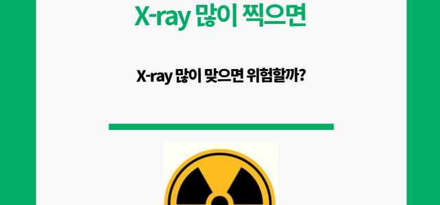 X-ray 많이 찍으면 위험할까?
