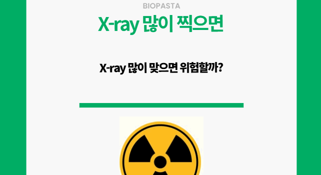 X-ray 많이 찍으면 위험할까?