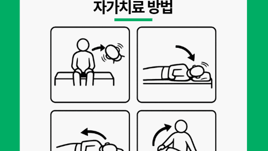 이석증 자가치료 방법 A to Z