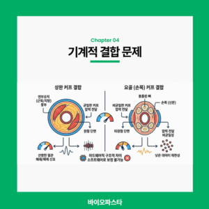 기계적 결합의 문제