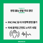 심전도 측정 방법의 차이