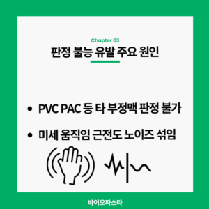 심전도 측정 방법의 차이