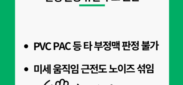 심전도 측정 방법의 차이