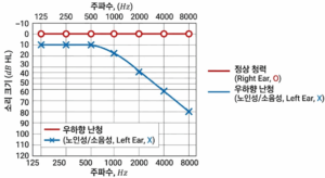 청력 주파수 그래프